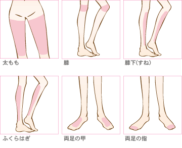 Legs(両脚)のレーザー脱毛　施術範囲